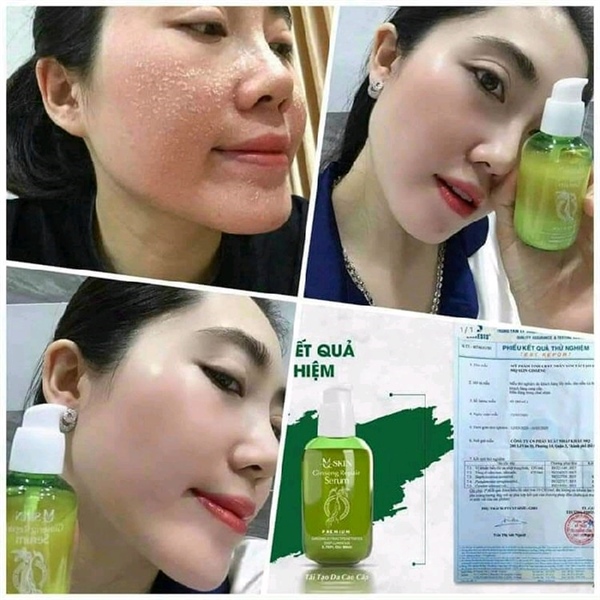 Serum MQ Skin Ginseng Repair Premium tái tạo da nhân sâm không sưng 80ml