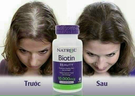 NATROL BIOTIN BEAUTY 10000MCG HỖ TRỢ NUÔI DƯỠNG TÓC ĐẸP