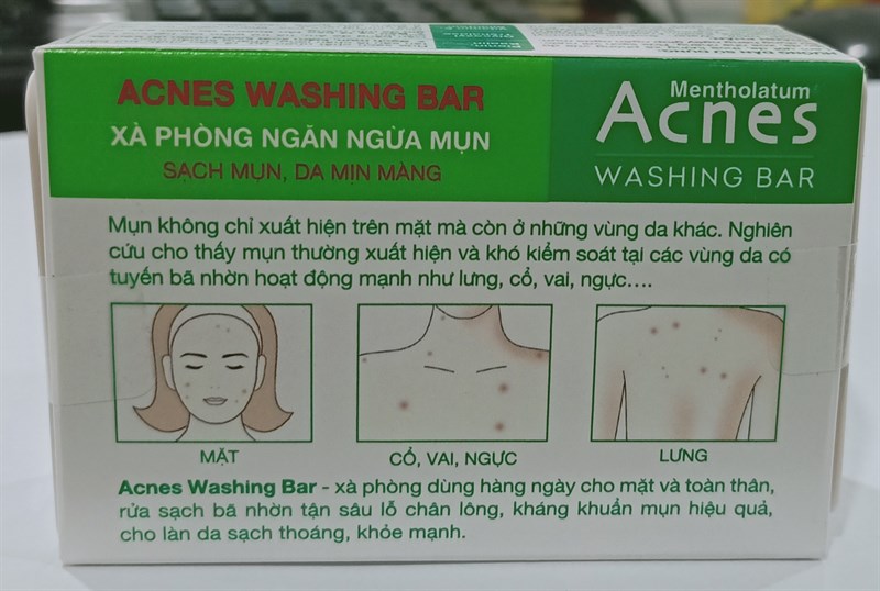 Xà phòng ngăn ngừa mụn (Acnes Washing Bar) 75g - Rohto/VN 2